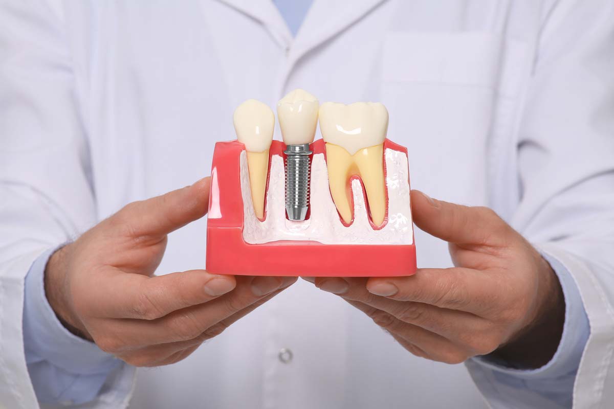 Oral dental surgery for complete dental health at Fatemeh Hadjian in Palm Desert, CA<br />
